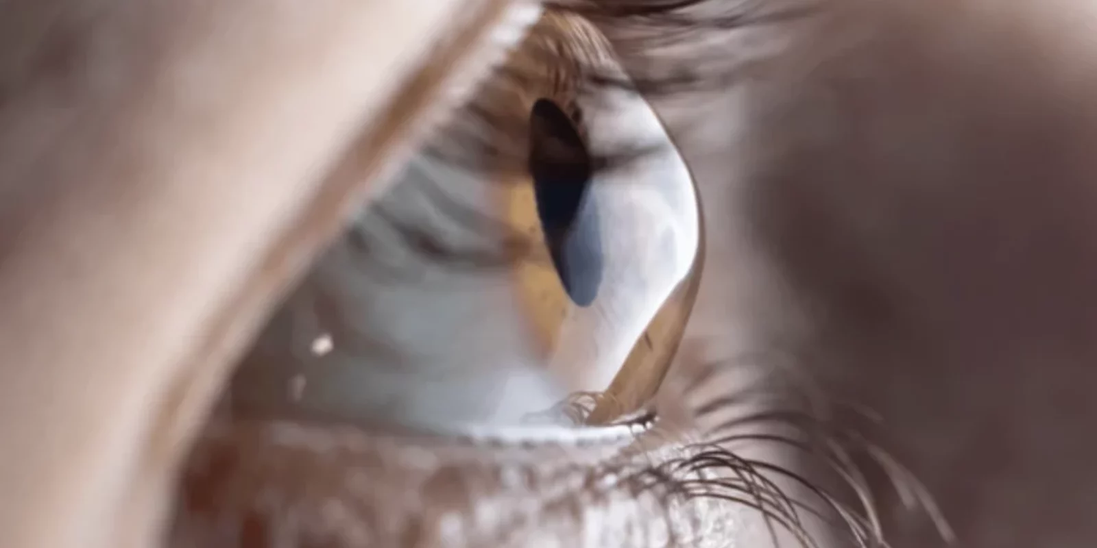 optiquedesvosges-strasbourg-lentilles